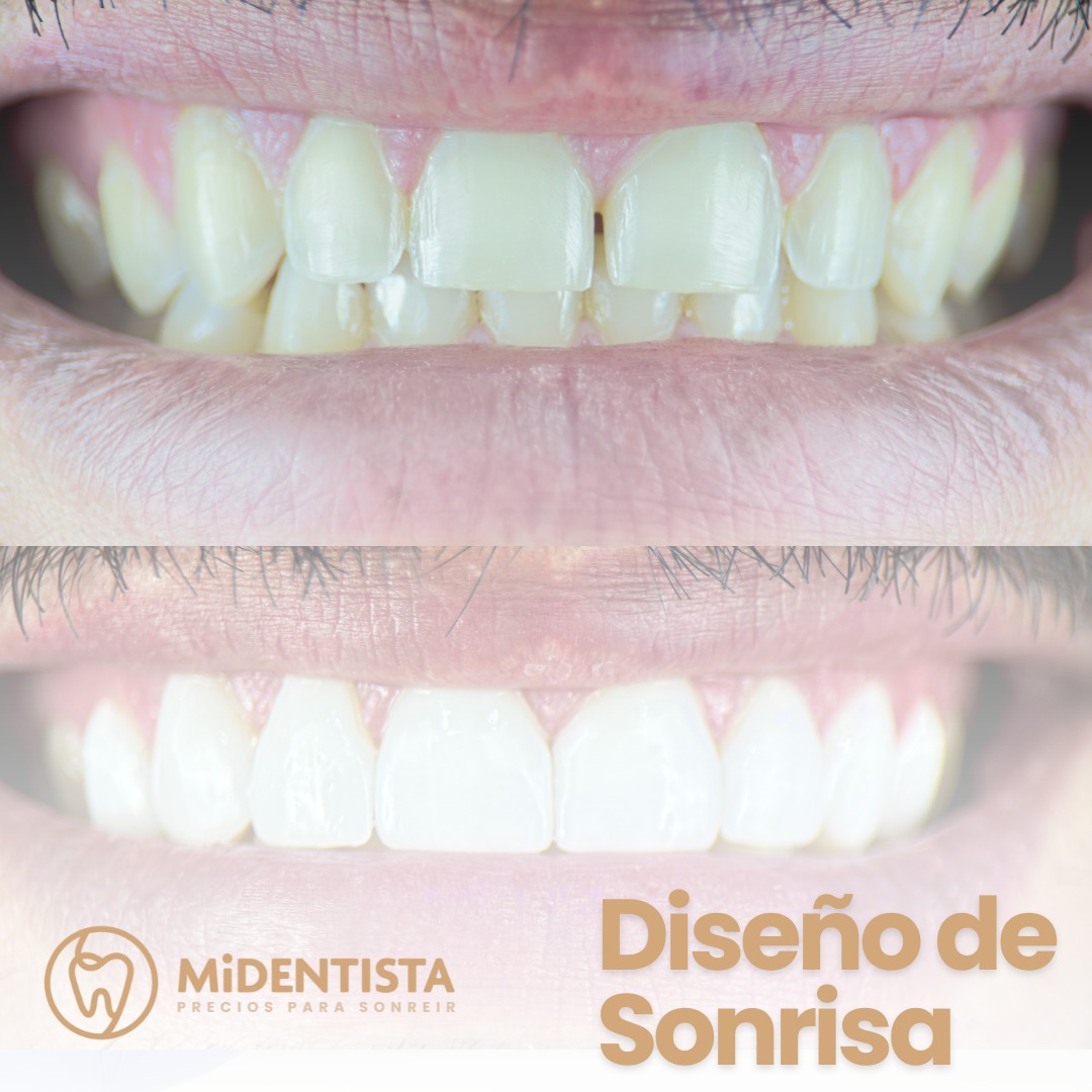 Mi Dentista